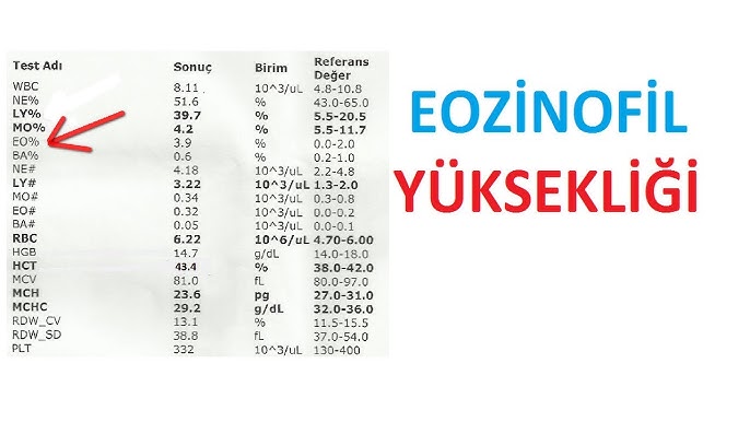 Eozinofil Yüzdesi Kaç Olmalı? Uzman Yorumlar [2026] - Kapak Görseli